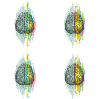 The Mind - Brain Dichotomy
