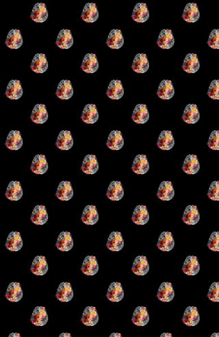 Love Your Brain