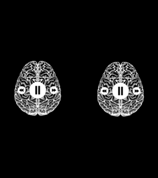 Brain Stop Psychology ADHD PTSD