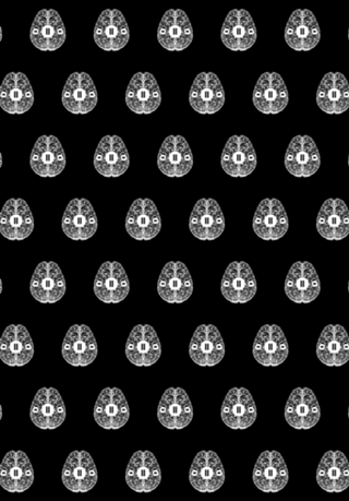 Brain Stop Psychology ADHD PTSD