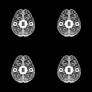 Brain Stop Psychology ADHD PTSD