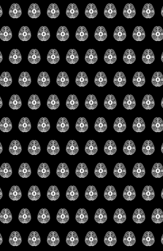 Brain Stop Psychology ADHD PTSD